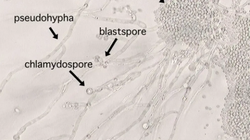 candida albicans